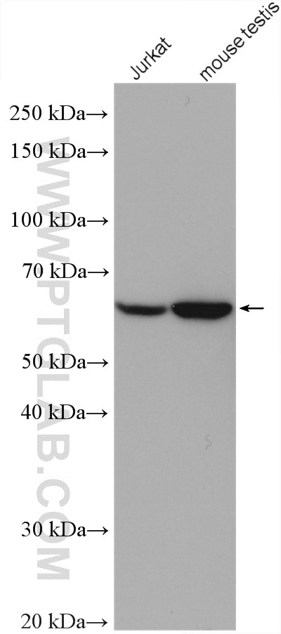 Western Blot (WB) analysis of various lysates using FEM1B Polyclonal antibody (11030-1-AP)