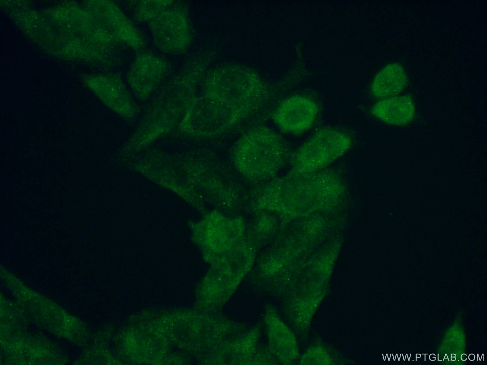 Immunofluorescence (IF) / fluorescent staining of PC-3 cells using FEM1B Polyclonal antibody (19544-1-AP)