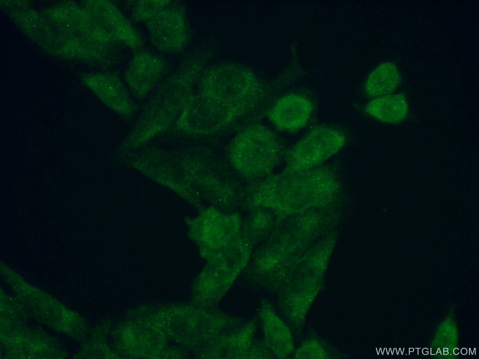 IF Staining of PC-3 using 19544-1-AP