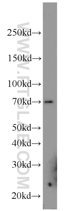 Western Blot (WB) analysis of RAW264.7 using FEM1B Polyclonal antibody (19544-1-AP)