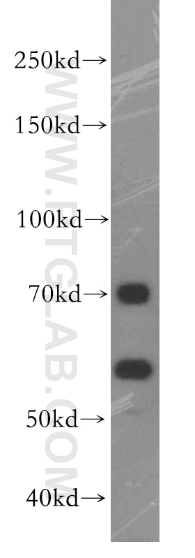 Western Blot (WB) analysis of PC-3 cells using FEM1B Polyclonal antibody (19544-1-AP)