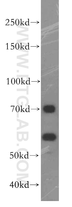 WB analysis of PC-3 using 19544-1-AP