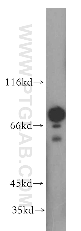 Western Blot (WB) analysis of mouse pancreas tissue using FEM1B Polyclonal antibody (19544-1-AP)