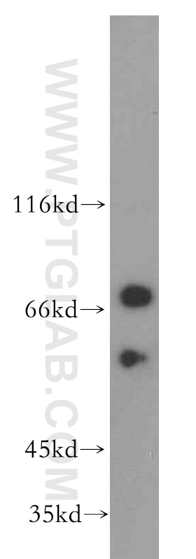 Western Blot (WB) analysis of mouse testis tissue using FEM1B Polyclonal antibody (19544-1-AP)