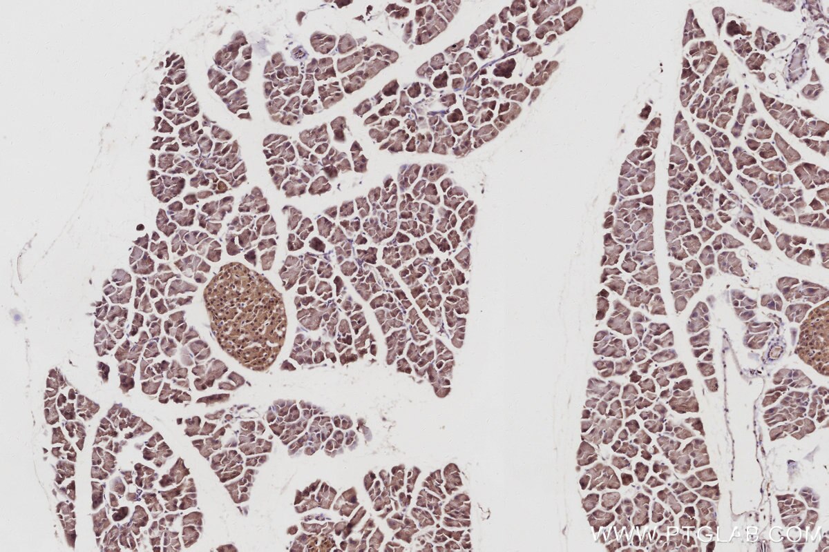 IHC staining of mouse pancreas using 83810-1-RR Immunohistochemistry (IHC) staining of mouse pancreas tissue using FEM1B Recombinant monoclonal antibody (83810-1-RR)