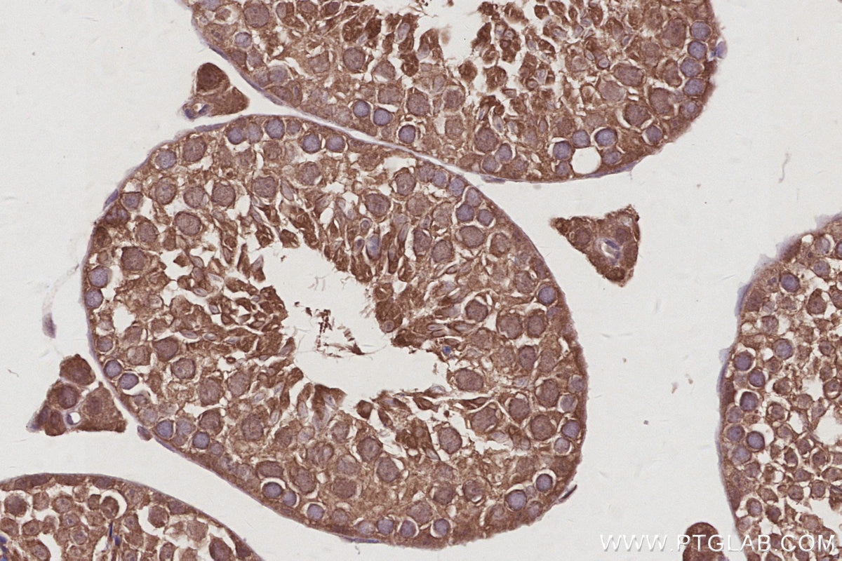 IHC staining of mouse testis using 83810-1-RR Immunohistochemistry (IHC) staining of mouse testis tissue using FEM1B Recombinant monoclonal antibody (83810-1-RR)