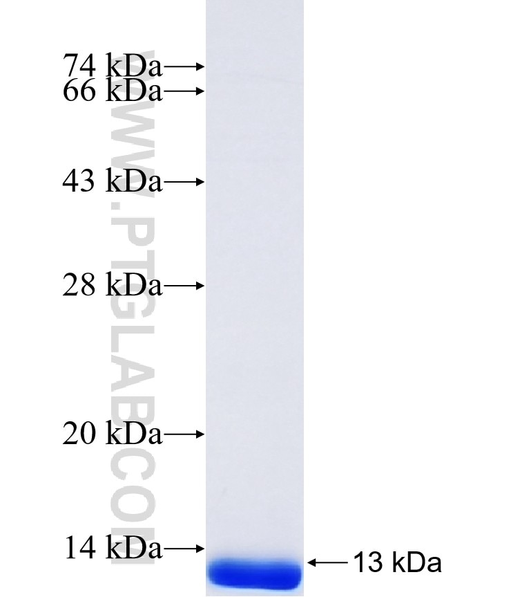 FEM1B fusion protein Ag41444 SDS-PAGE FEM1B fusion protein Ag41444 SDS-PAGE