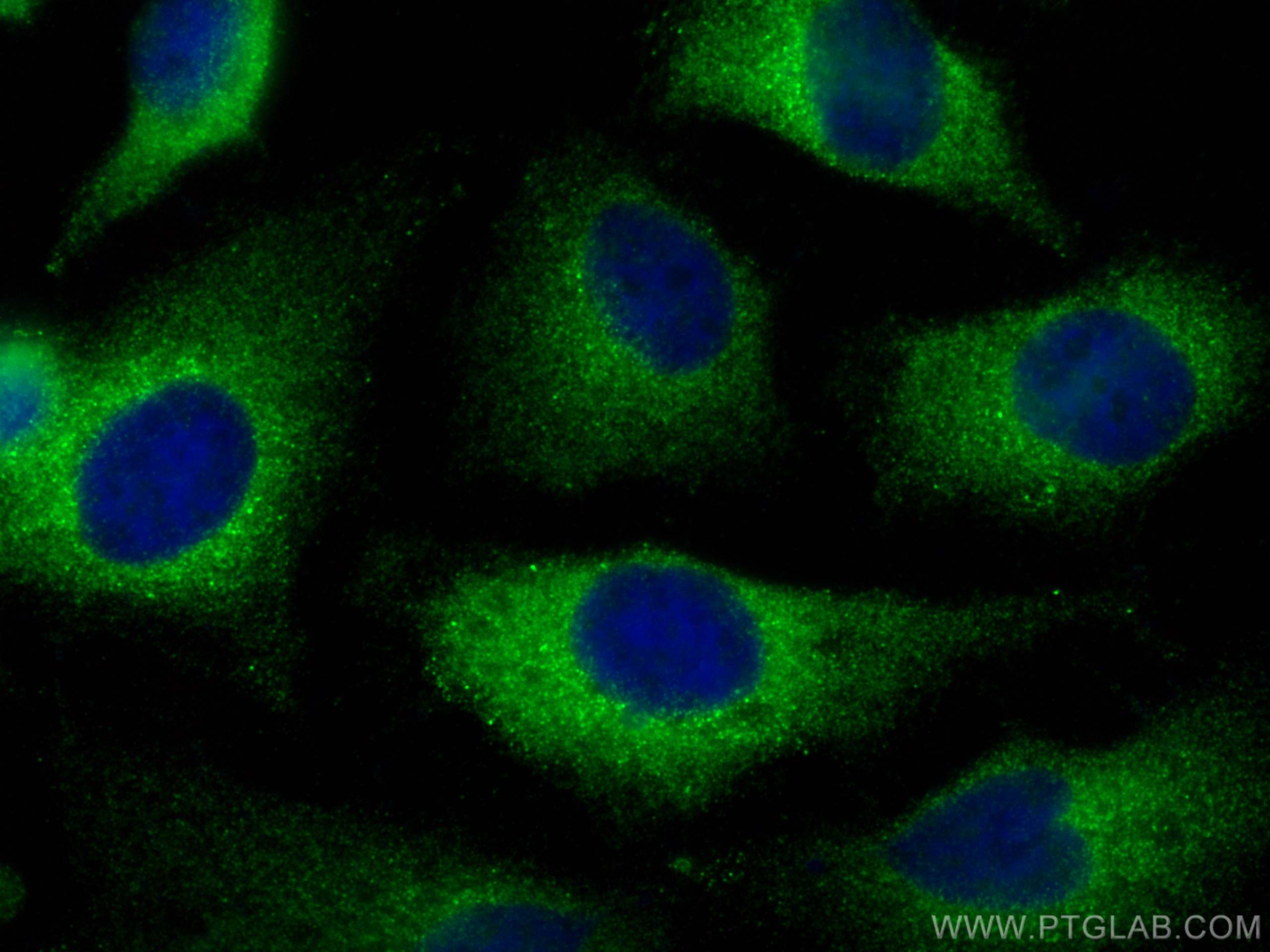 Immunofluorescence (IF) / fluorescent staining of HeLa cells using FEM1C Polyclonal antibody (14037-1-AP)