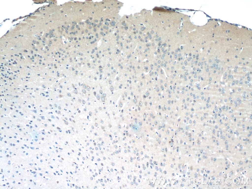 Immunohistochemistry (IHC) staining of mouse brain tissue using FEM1C Polyclonal antibody (14037-1-AP)