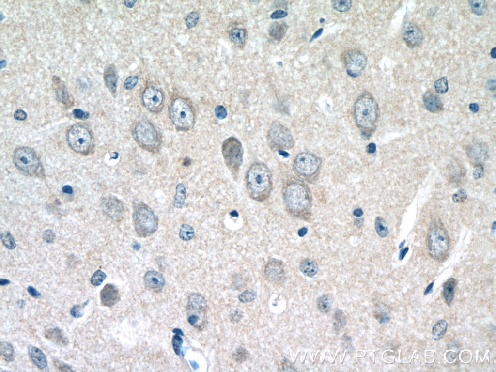 Immunohistochemistry (IHC) staining of mouse brain tissue using FEM1C Polyclonal antibody (14037-1-AP)