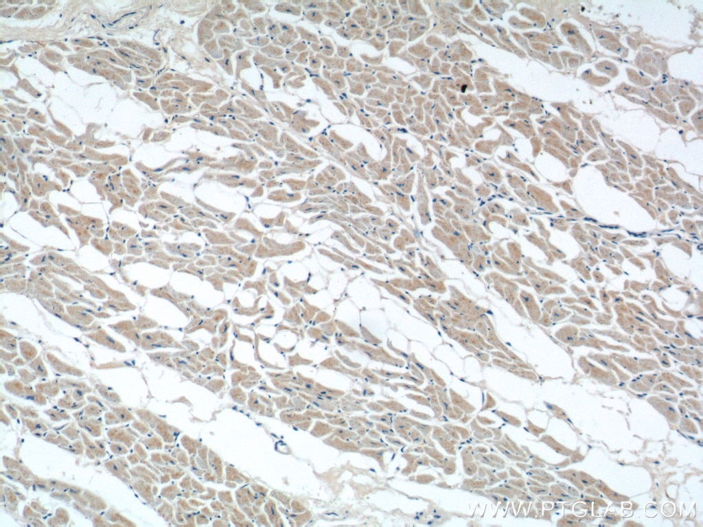Immunohistochemistry (IHC) staining of human heart tissue using FEM1C Polyclonal antibody (14037-1-AP)