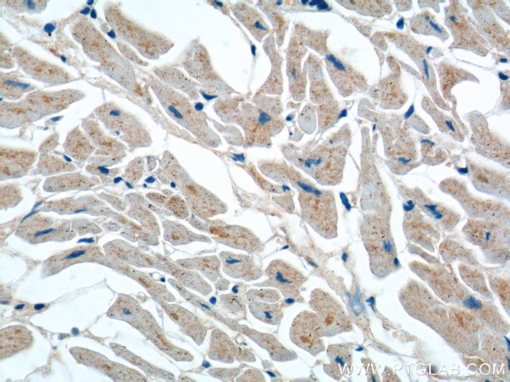 Immunohistochemistry (IHC) staining of human heart tissue using FEM1C Polyclonal antibody (14037-1-AP)