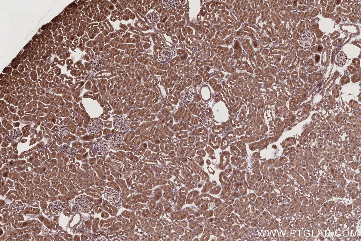 Immunohistochemistry (IHC) staining of mouse kidney tissue using FEM1C Polyclonal antibody (14037-1-AP)
