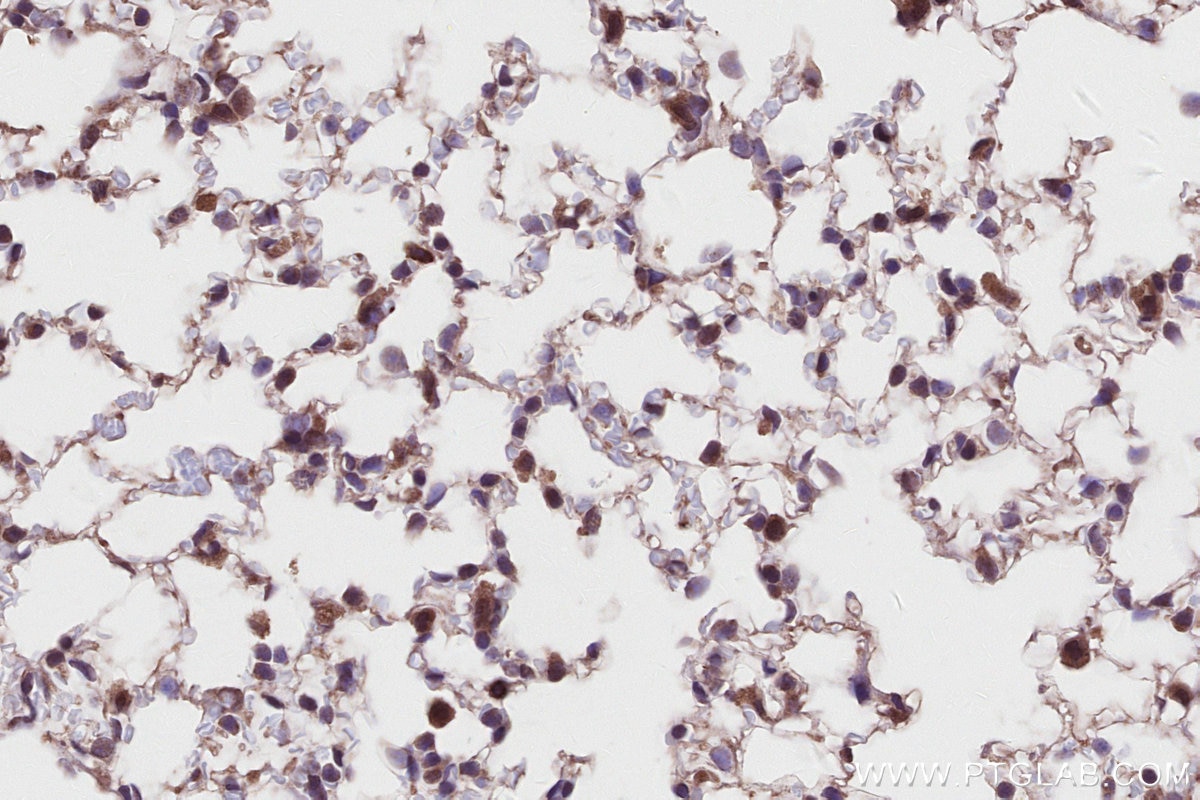 Immunohistochemistry (IHC) staining of mouse lung tissue using FEM1C Polyclonal antibody (14037-1-AP)