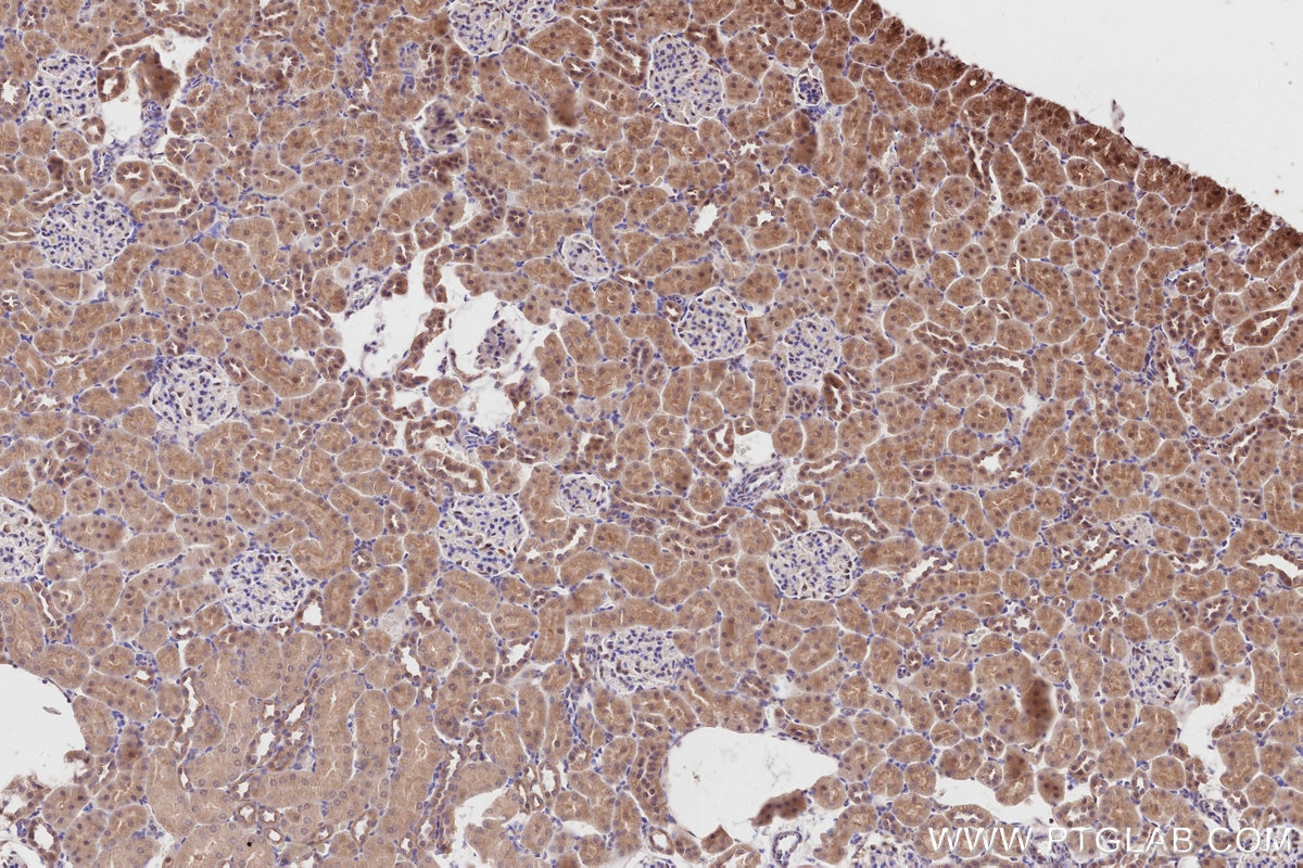 Immunohistochemistry (IHC) staining of rat kidney tissue using FEM1C Polyclonal antibody (14037-1-AP)