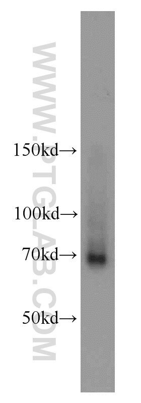 Western Blot (WB) analysis of mouse brain tissue using FEM1C Polyclonal antibody (14037-1-AP)