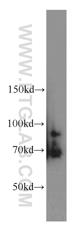 Western Blot (WB) analysis of mouse brain tissue using FEM1C Polyclonal antibody (14037-1-AP)