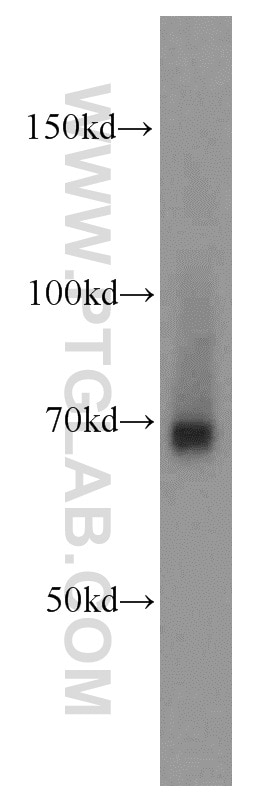 Western Blot (WB) analysis of mouse heart tissue using FEM1C Polyclonal antibody (14037-1-AP)