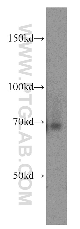 Western Blot (WB) analysis of mouse heart tissue using FEM1C Polyclonal antibody (14037-1-AP)