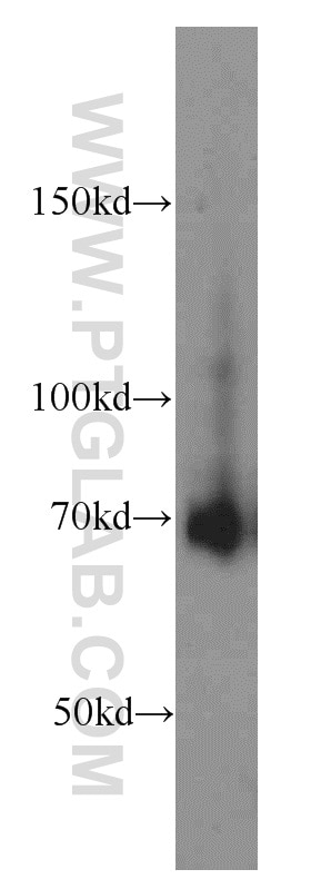 Western Blot (WB) analysis of HepG2 cells using FEM1C Polyclonal antibody (14037-1-AP)