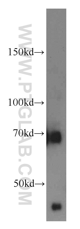 Western Blot (WB) analysis of HepG2 cells using FEM1C Polyclonal antibody (14037-1-AP)