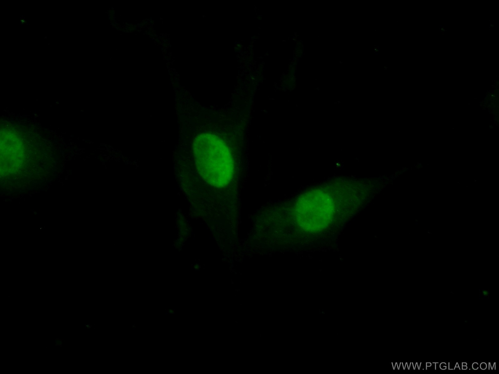 Immunofluorescence (IF) / fluorescent staining of NIH/3T3 cells using FEN1 Polyclonal antibody (14768-1-AP)