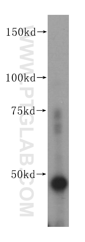 FEN1 Polyclonal antibody