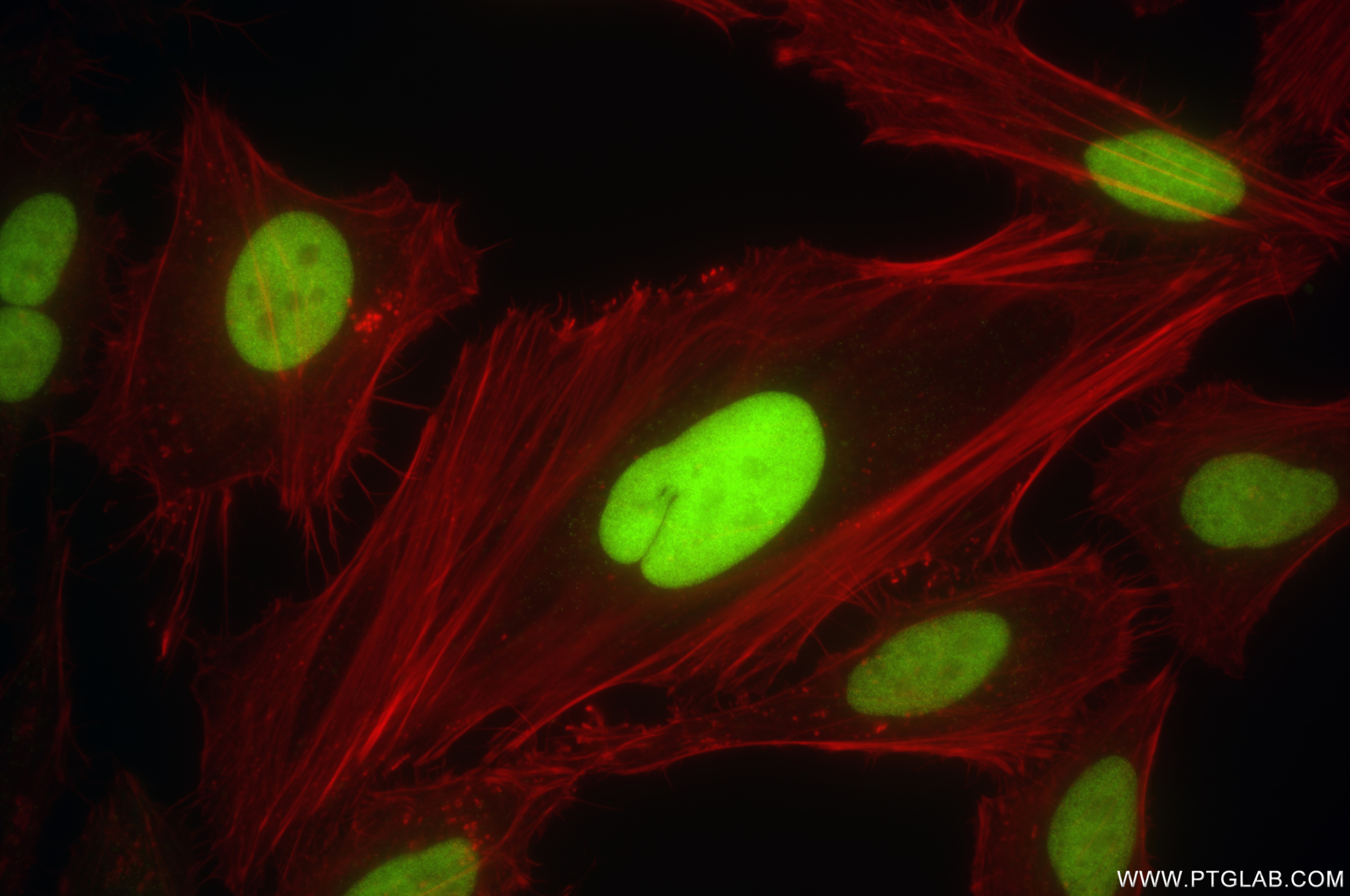 Immunofluorescence (IF) / fluorescent staining of HeLa cells using FEN1 Recombinant antibody (84916-5-RR)