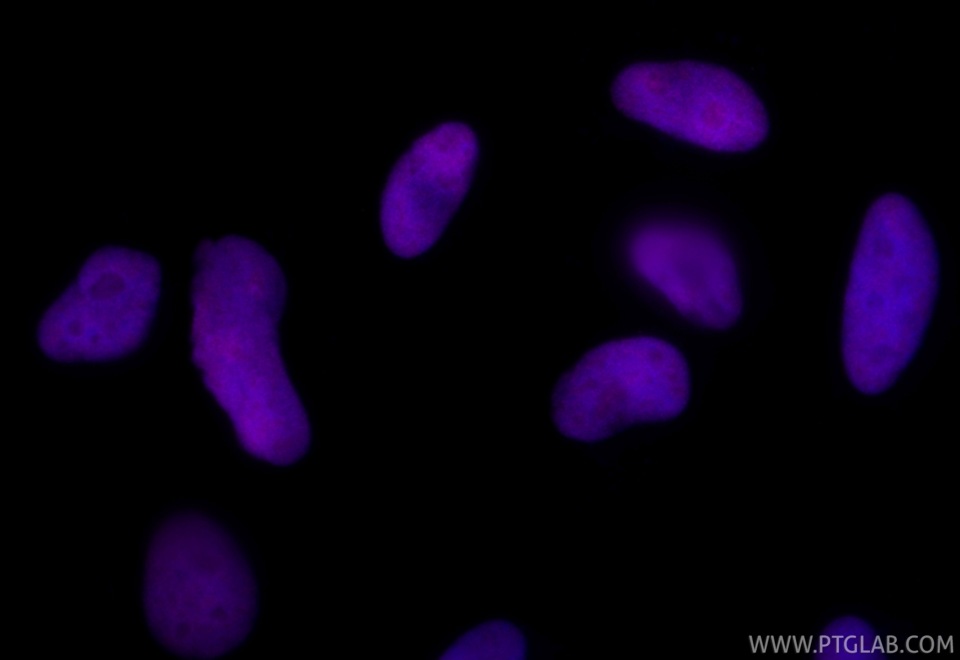 Immunofluorescence (IF) / fluorescent staining of HeLa cells using CoraLite® Plus 647-conjugated FEN1 Recombinant ant (CL647-84916-5)