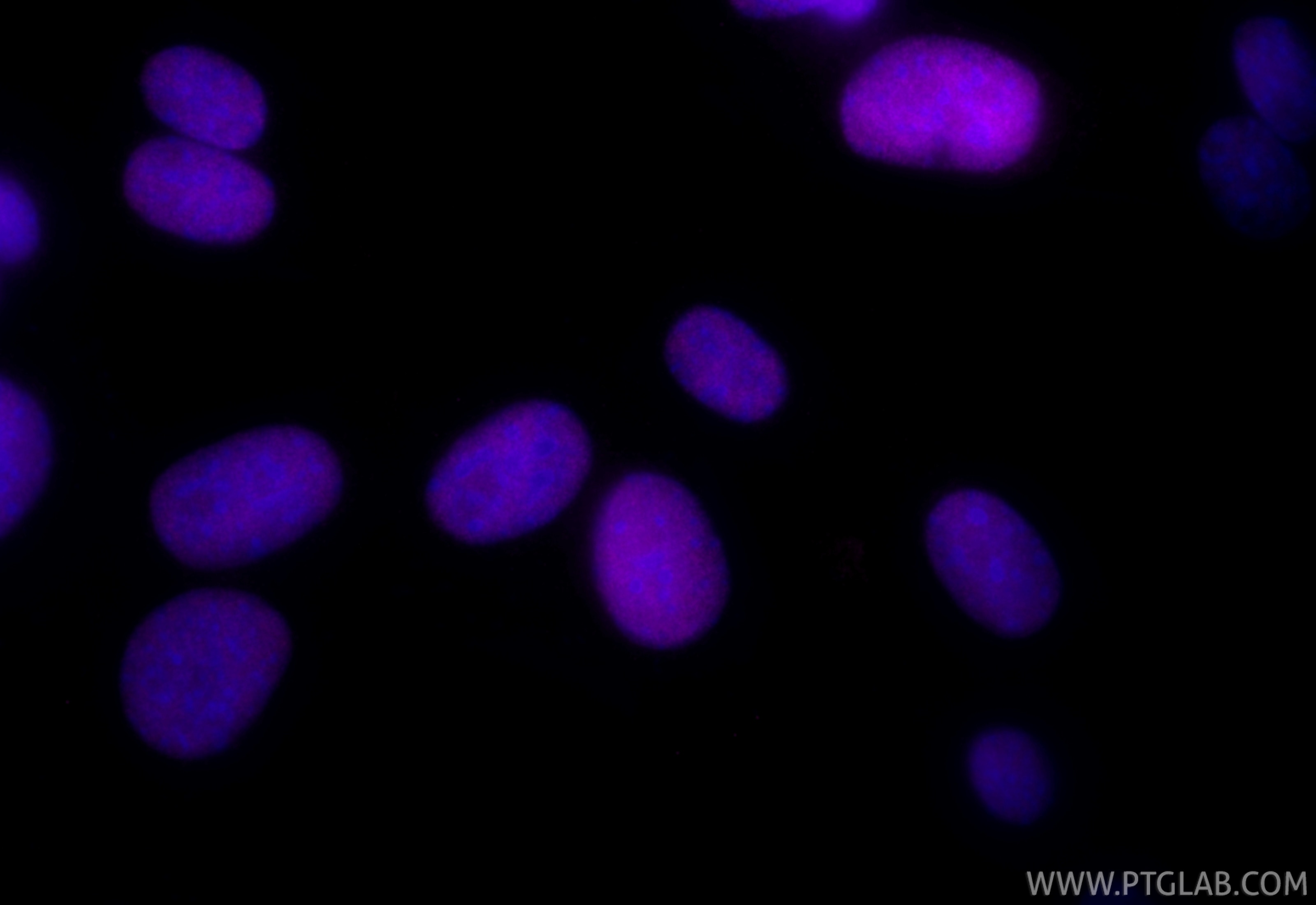 Immunofluorescence (IF) / fluorescent staining of NIH/3T3 cells using CoraLite® Plus 647-conjugated FEN1 Recombinant ant (CL647-84916-5)