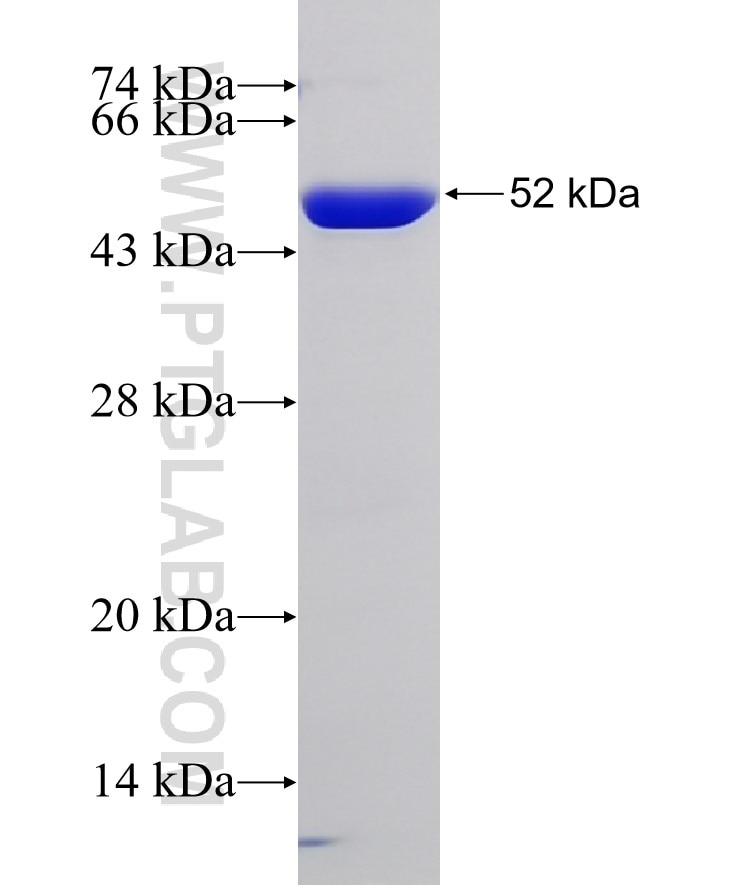 FEN1 fusion protein Ag33331 SDS-PAGE FEN1 fusion protein Ag33331 SDS-PAGE