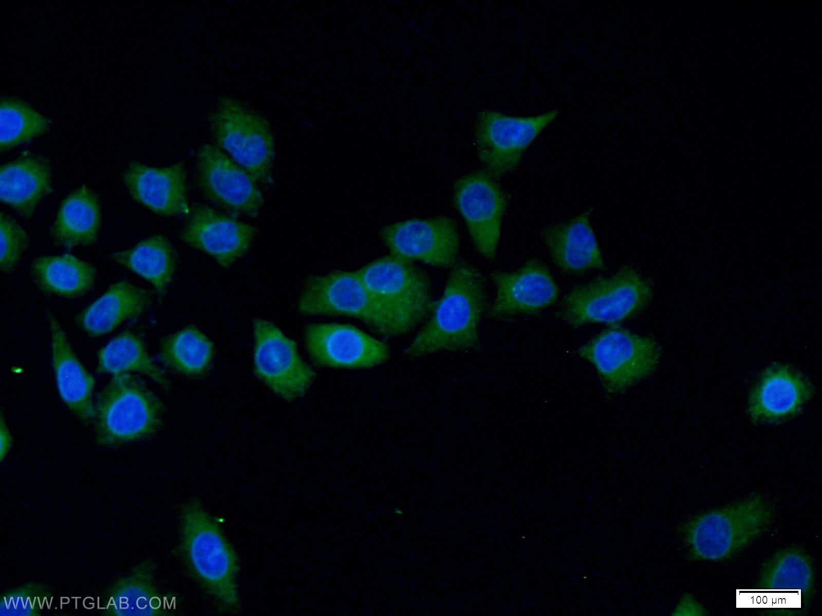 Immunofluorescence (IF) / fluorescent staining of MCF-7 cells using FER Polyclonal antibody (25287-1-AP)