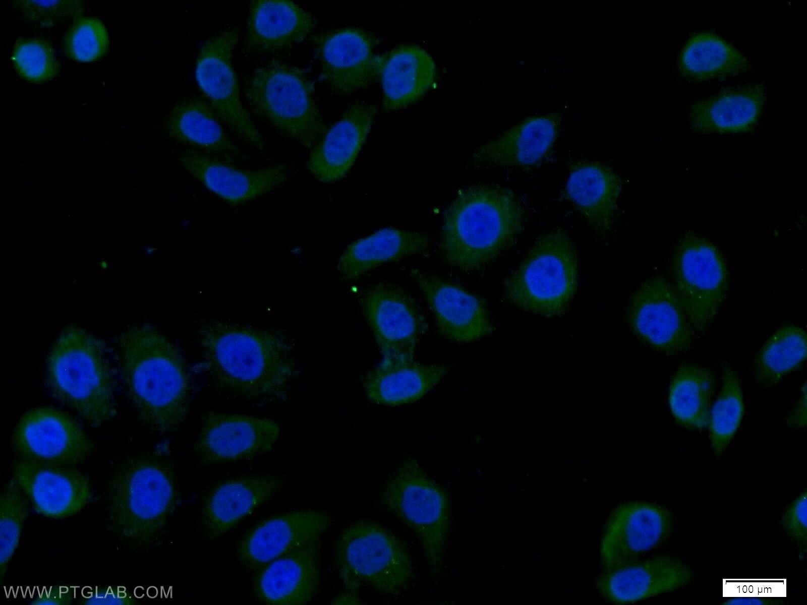 Immunofluorescence (IF) / fluorescent staining of MCF-7 cells using FER Polyclonal antibody (25287-1-AP)