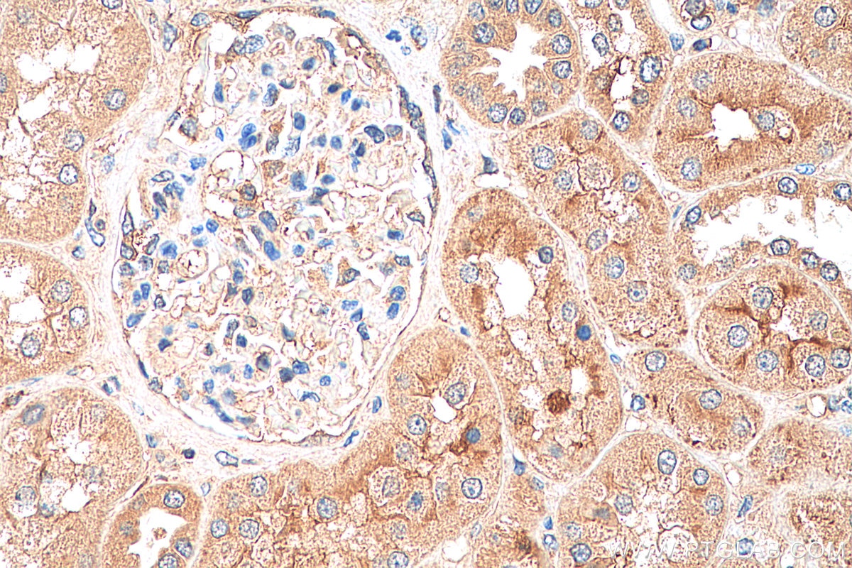 Immunohistochemistry (IHC) staining of human kidney tissue using FER Polyclonal antibody (25287-1-AP)