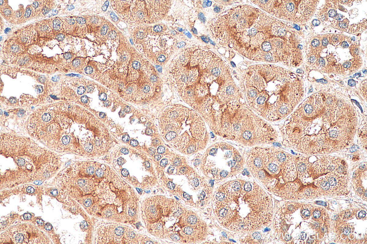 Immunohistochemistry (IHC) staining of human kidney tissue using FER Polyclonal antibody (25287-1-AP)