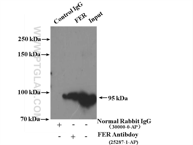 Immunoprecipitation (IP) experiment of MCF-7 cells using FER Polyclonal antibody (25287-1-AP)