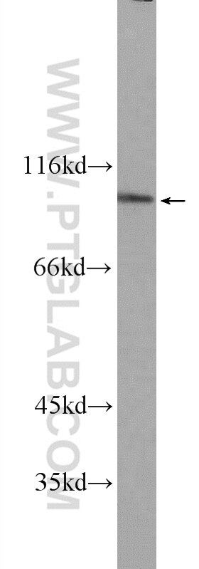 Western Blot (WB) analysis of A431 cells using FER Polyclonal antibody (25287-1-AP)