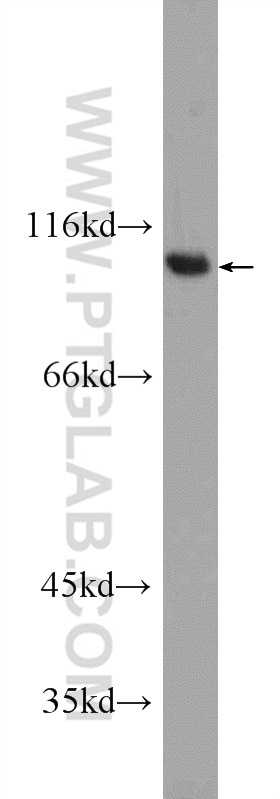 Western Blot (WB) analysis of MCF-7 cells using FER Polyclonal antibody (25287-1-AP)