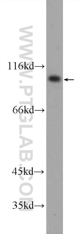 Western Blot (WB) analysis of HeLa cells using FER Polyclonal antibody (25287-1-AP)