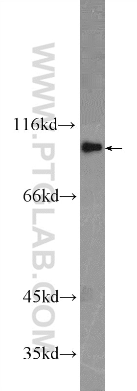 Western Blot (WB) analysis of NIH/3T3 cells using FER Polyclonal antibody (25287-1-AP)