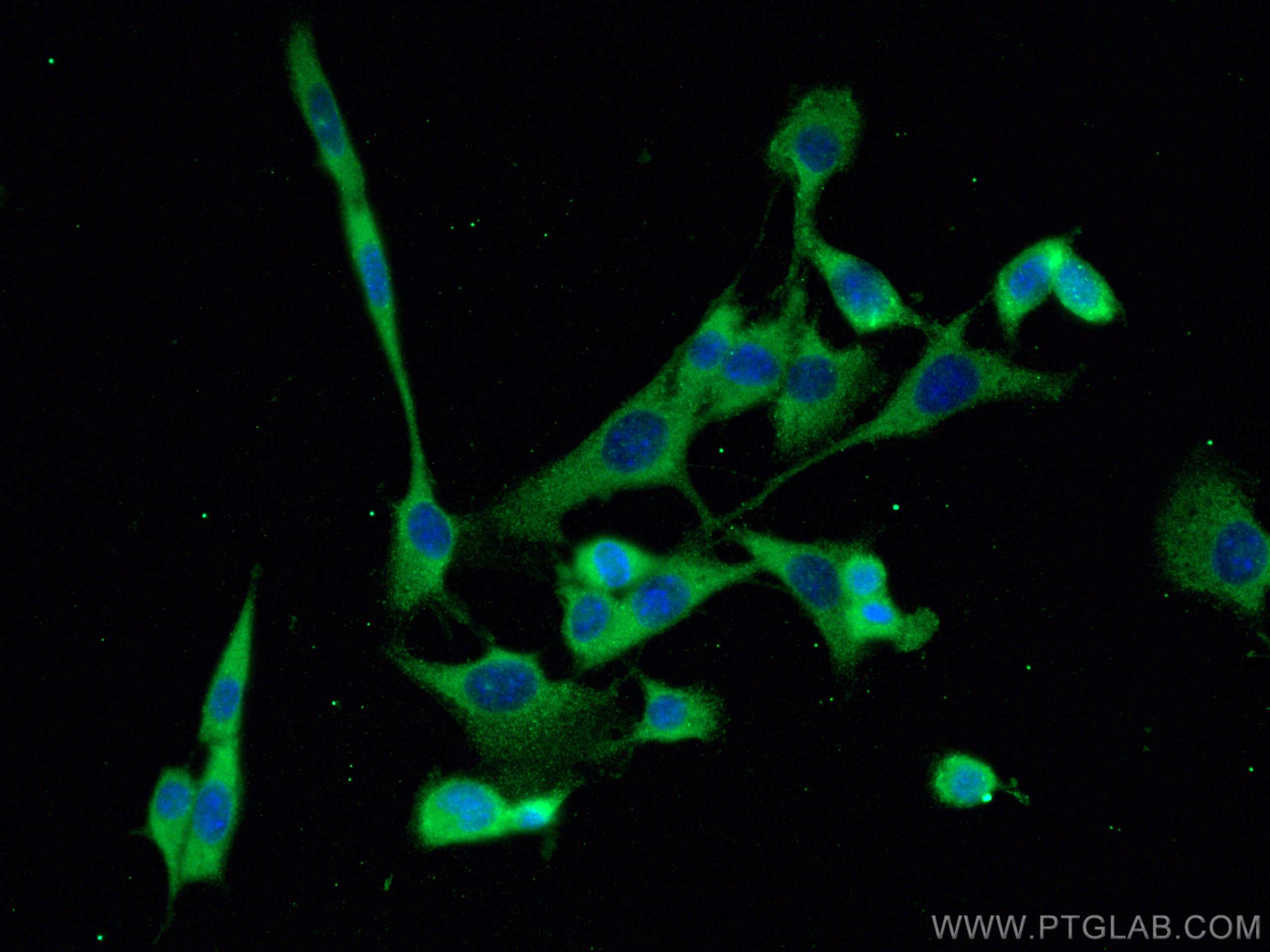Immunofluorescence (IF) / fluorescent staining of NIH/3T3 cells using FER Monoclonal antibody (67671-1-Ig)