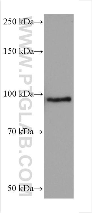 WB analysis of 4T1 using 67671-1-Ig