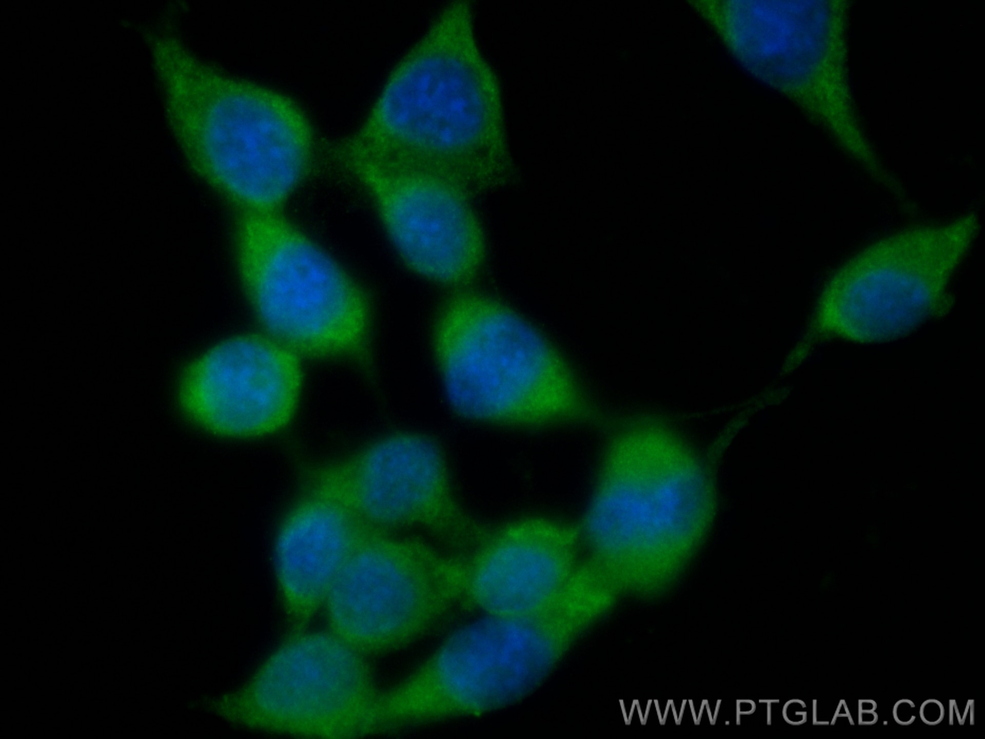 Immunofluorescence (IF) / fluorescent staining of NIH/3T3 cells using CoraLite® Plus 488-conjugated FER Monoclonal antib (CL488-67671)