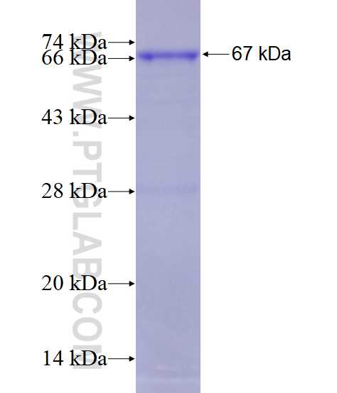 FER fusion protein Ag18173 SDS-PAGE