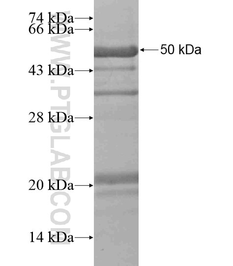 FER fusion protein Ag19176 SDS-PAGE