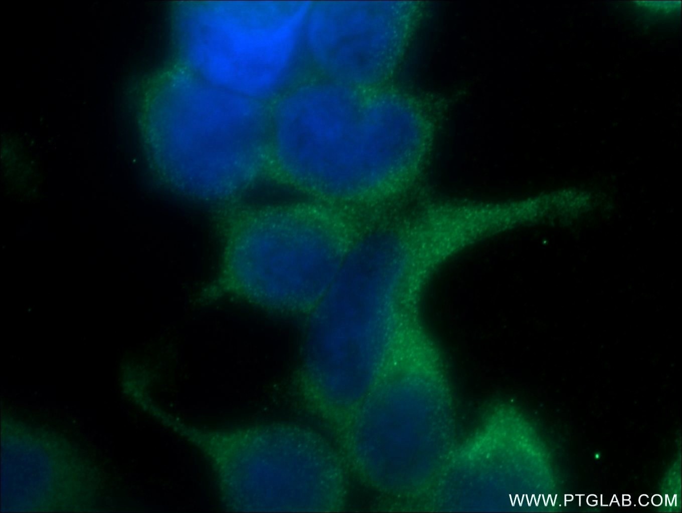 Immunofluorescence (IF) / fluorescent staining of HEK-293 cells using Kindlin 1 Polyclonal antibody (22215-1-AP)