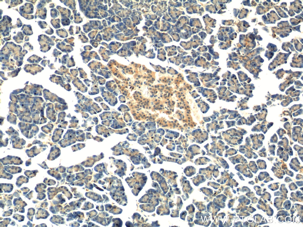 Immunohistochemistry (IHC) staining of human pancreas tissue using Kindlin 1 Polyclonal antibody (22215-1-AP)