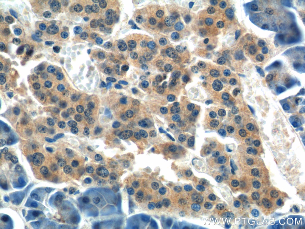 Immunohistochemistry (IHC) staining of human pancreas tissue using Kindlin 1 Polyclonal antibody (22215-1-AP)