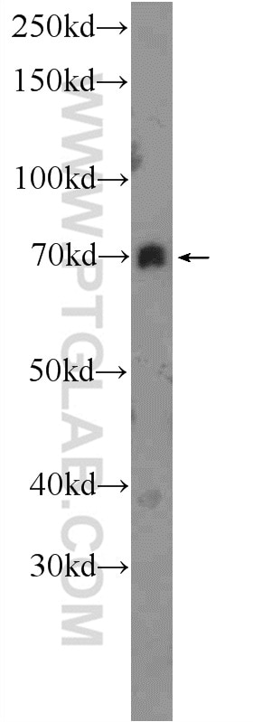 Western Blot (WB) analysis of mouse kidney tissue using Kindlin 1 Polyclonal antibody (22215-1-AP)