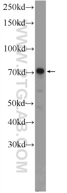Western Blot (WB) analysis of COLO 320 cells using Kindlin 1 Polyclonal antibody (22215-1-AP)